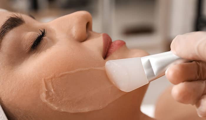 Woman receiving skin peel